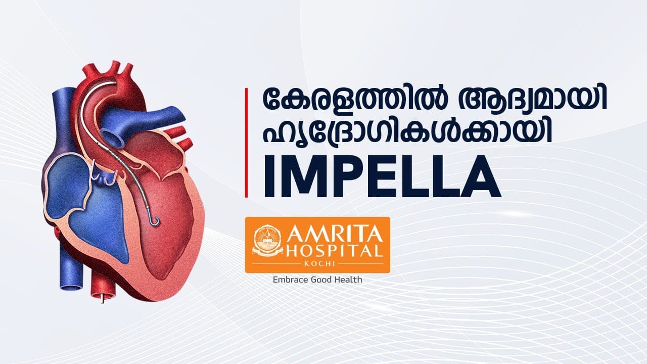 Empowering Your Heart to Beat Stronger - Impella, The Cardiac Savior