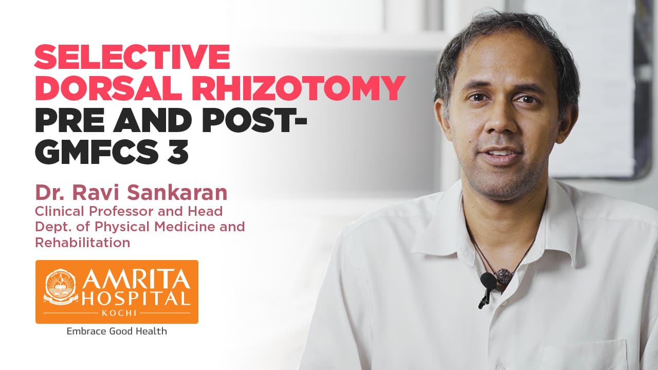 Selective Dorsal Rhizotomy pre and post- GMFCS 3