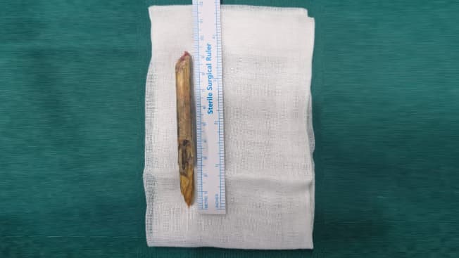 Telemedicine Van Camp Report at Kasuvinahalli Village