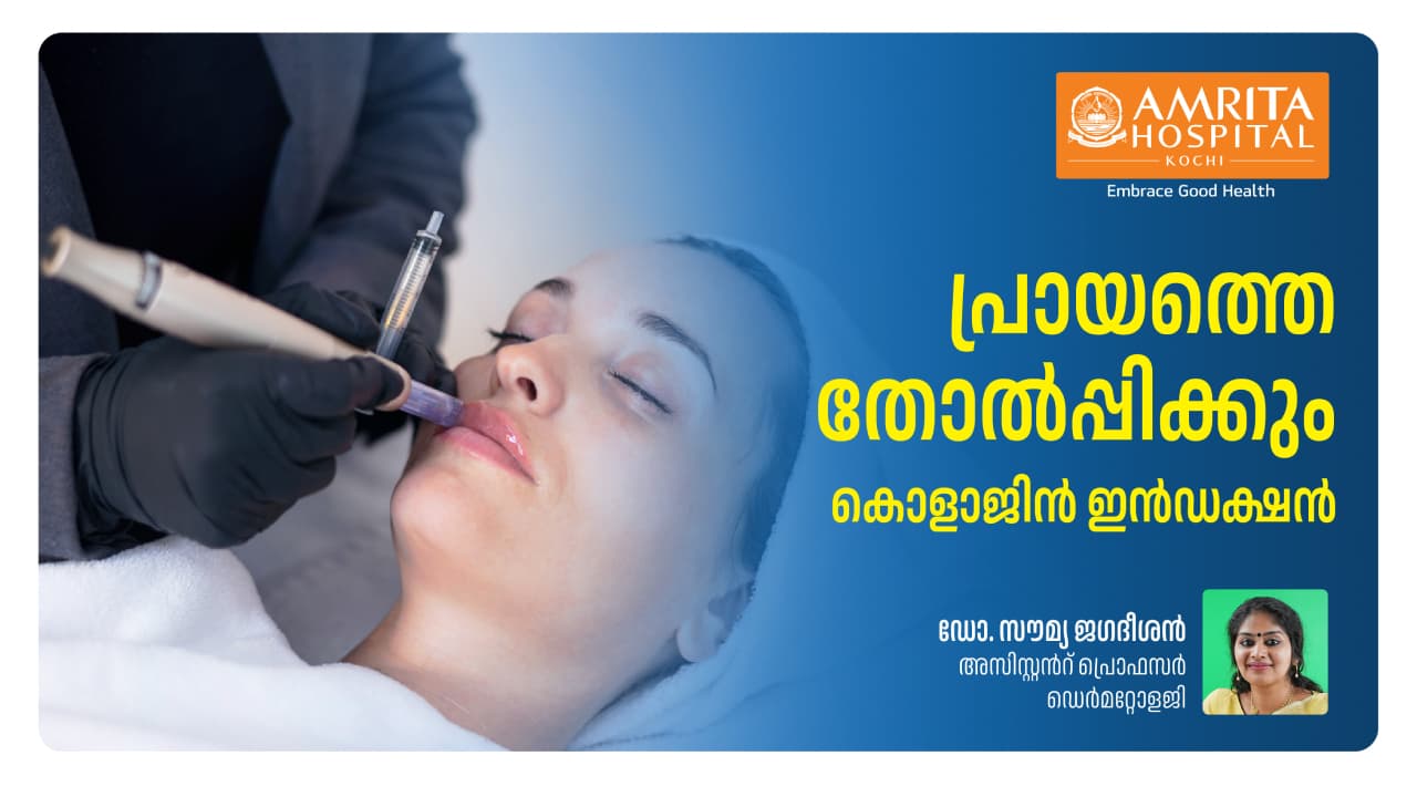 മൈക്രോ നീഡിലിംഗ് റേഡിയോ ഫ്രീക്വൻസി ചർമ്മത്തിൽ സൃഷ്ടിക്കുന്ന മാജിക്ക്