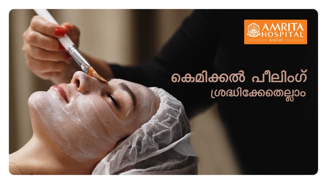 കെമിക്കൽ പീലിംഗിൽ ശ്രദ്ധിക്കേണ്ടത് എന്തെല്ലാം?